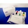 鸡禽流感病毒（H5型）抗体检测试剂盒